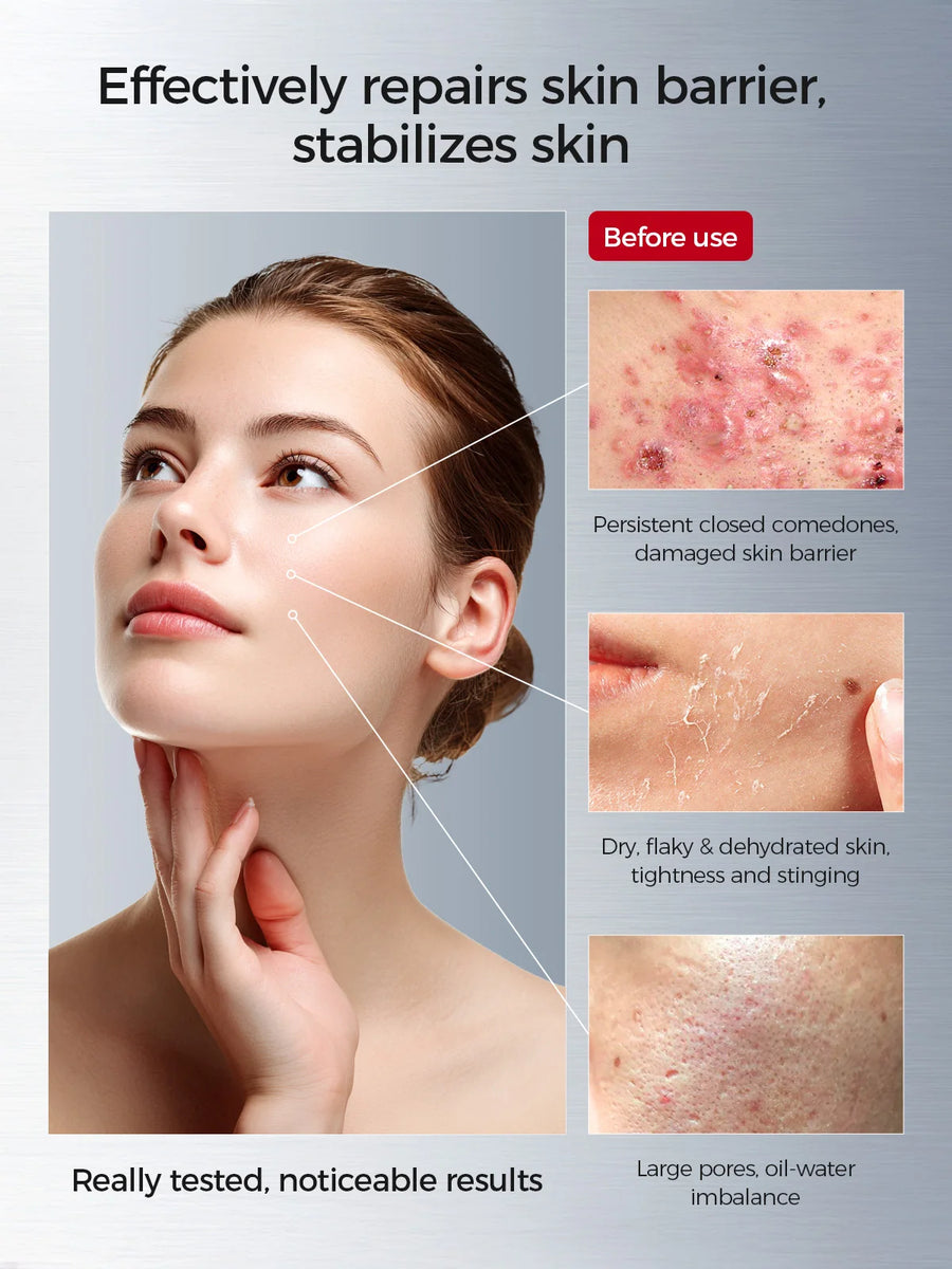Kit Skincare Tembusu Rotina 8 Passos BellaVita - foto 17